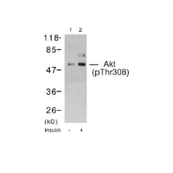 Abcam Rabbit polyclonal to AKT (phospho T308), Quantity: Each of 1