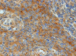 Abcam Rabbit polyclonal to FMRP, Quantity: Each of 1