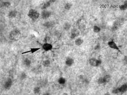 Abcam Mouse monoclonal [5C10, ADD] to CaSR, Quantity: Each of 1