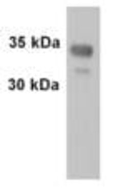 Abcam Rabbit polyclonal to Synaptophysin, Quantity: Each of 1