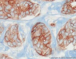 Abcam Rabbit polyclonal to EpCAM, Quantity: Each of 1