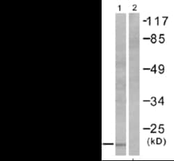 Abcam Rabbit polyclonal to Oligodendrocyte Specific Protein - Oligodendrocyte