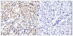 Abcam Rabbit polyclonal to p27 KIP 1 (phospho T187), Quantity: Each of