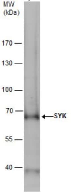 Abcam Rabbit polyclonal to Syk, Quantity: Each of 1