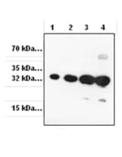 Abcam Anti-RFP antibody, Quantity: Each of 1