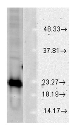 Abcam Rabbit polyclonal to Superoxide Dismutase 1, Quantity: Each of 1