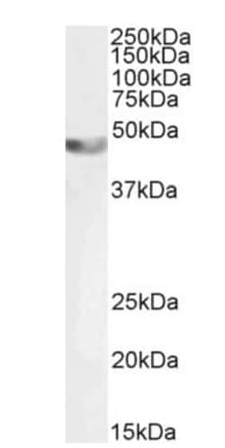 Abcam Goat polyclonal to alpha smooth muscle Actin, Quantity: Each of 1