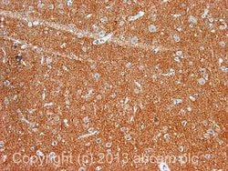 Abcam Mouse monoclonal [SAP7F407] to Bassoon/BSN, Quantity: Each of 1