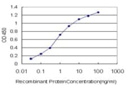 Abcam Mouse monoclonal [3B6] to Glutamine Synthetase - BSA and Azide free,