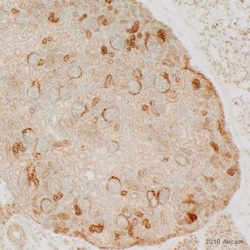 Abcam Rabbit polyclonal to Claudin 1, Quantity: Each of 1