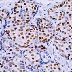 Abcam Mouse and Rabbit Specific HRP/DAB Detection IHC kit, Quantity: Each