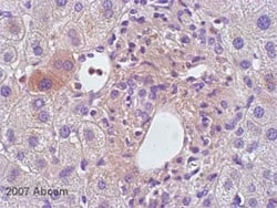 Abcam Rabbit polyclonal to IL-1 beta, Quantity: Each of 1