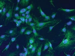 Lonza Walkersville Mouse Embryonic Fibroblasts (MEF)