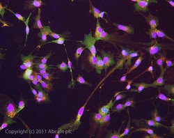 Abcam Rabbit polyclonal to Interferon beta, Quantity: Each of 1