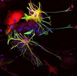 Abcam Rabbit polyclonal to ALDH1L1 - Astrocyte Marker, Quantity: Each of