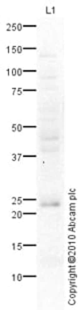 Abcam Rabbit polyclonal to CD63, Quantity: Each of 1