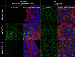 Abcam Recombinant human EGF protein (Animal Free), 500UG, Quantity: Each