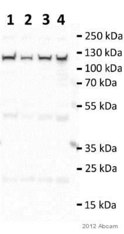Abcam Rabbit polyclonal to TRPV4, Quantity: Each of 1