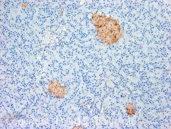 Abcam Mouse monoclonal [13C4 / I3C4] to PGP9.5, Quantity: Each of 1