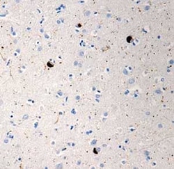 Abcam Mouse monoclonal [P-syn/81A] to Alpha-synuclein (phospho S129), Quantity: