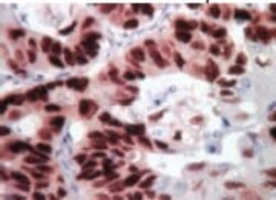 Abcam Mouse specific HRP/DAB Detection IHC Kit, 15ML