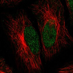Abcam Mouse monoclonal [CL0537] to ATRX, Quantity: Each of 1