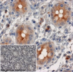 Abcam Rabbit Anti-Rat IgG H&L (HRP), Quantity: Each of 1