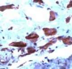 Abcam Rabbit polyclonal to COX2 / Cyclooxygenase 2, Quantity: Each of 1