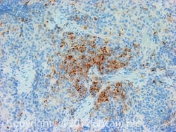 Abcam Mouse monoclonal [MRC OX-6] to MHC Class II, Quantity: Each of 1
