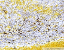 Fd Neurotechnologies Inc&nbsp;FD NEURO SILVER KIT