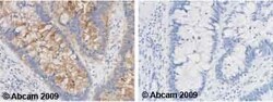 Abcam Rabbit polyclonal to p15 INK4b, Quantity: Each of 1