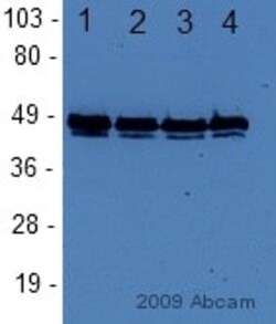 Abcam Rabbit polyclonal to FOXA1, Quantity: Each of 1