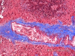 Abcam Trichrome Stain Kit (Connective Tissue Stain), Quantity: Each of