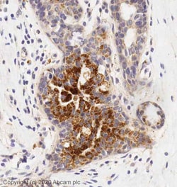 Abcam Rabbit polyclonal to Thrombospondin 1, Quantity: Each of 1