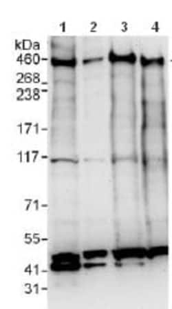 Abcam Rabbit polyclonal to BRCA2, Quantity: Each of 1