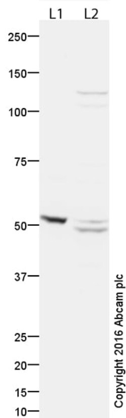 Abcam Rabbit polyclonal to PNPLA3, Quantity: Each of 1