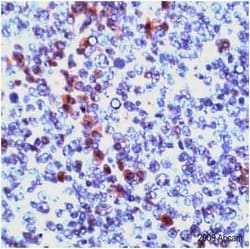 Abcam Rabbit polyclonal to Granzyme B, Quantity: Each of 1