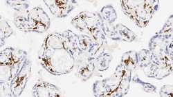 Leica Biosystems MOUSE ANTI-CD163 ANTIBODY. CL, Quantity: Each of 1