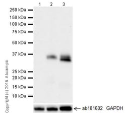 Abcam Recombinant human TGF beta 1 protein (Active), Quantity: Each of