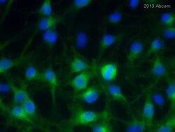 Abcam Anti-TRP2/DCT antibody, Quantity: Each of 1