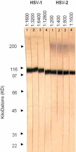 Abcam Mouse monoclonal [10B7] to HSV1 + HSV2 gB, Quantity: Each of 1