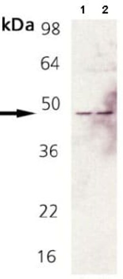 Abcam Rabbit polyclonal to Fas, Quantity: Each of 1