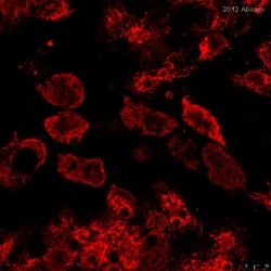 Abcam Rabbit polyclonal to Calreticulin - ER Marker, Quantity: Each of