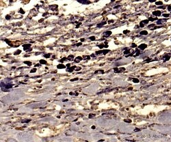 Abcam Rabbit polyclonal to CD45, Quantity: Each of 1