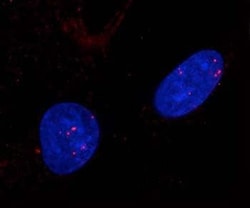 Abcam Rabbit polyclonal to Rad51, Quantity: Each of 1