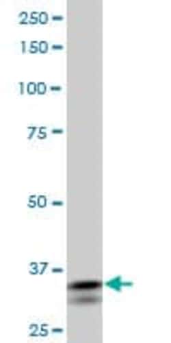 Abcam Mouse monoclonal [1D1] to SHOX2, Quantity: Each of 1