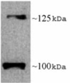 Abcam Rabbit polyclonal to Leptin Receptor, Quantity: Each of 1
