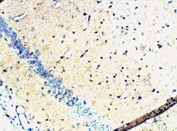 Abcam Rabbit polyclonal to Synaptophysin, Quantity: Each of 1