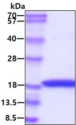 Abcam Recombinant human Interferon alpha 1 protein (Active), 100UG, Quantity:
