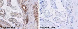 Abcam Mouse monoclonal [EIF2a] to EIF2S1, Quantity: Each of 1